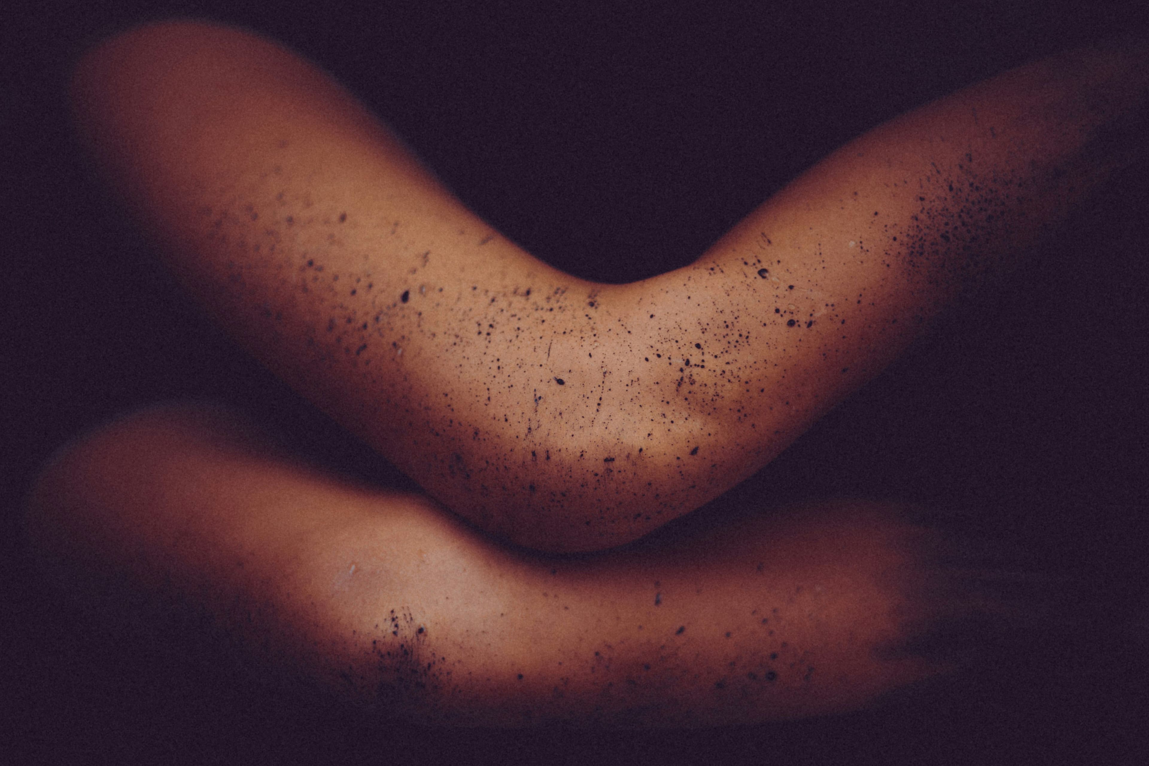 Comfort And Care For Vulnerable Skin